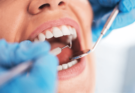 Dental Health Basics