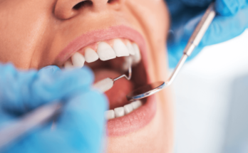 Dental Health Basics
